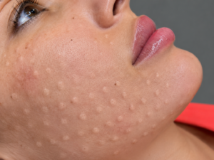 vasilica-manchester-aesthetics-skin-clinic-rejuvenation-home