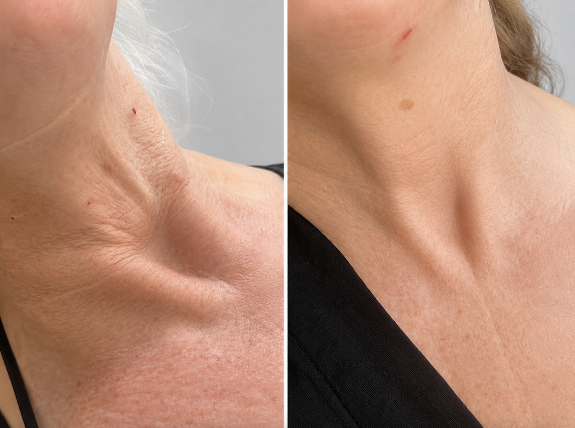 aesthetic-practitioner-manchester-decotage-result-book-vasilica