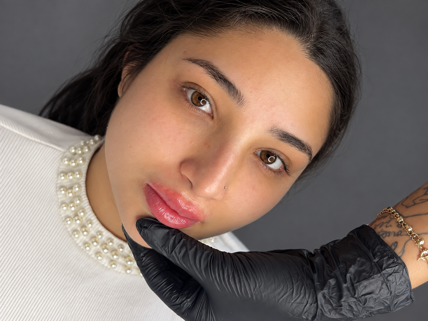vasilica-manchester-aesthetic-lips-filler-restore-vasilica