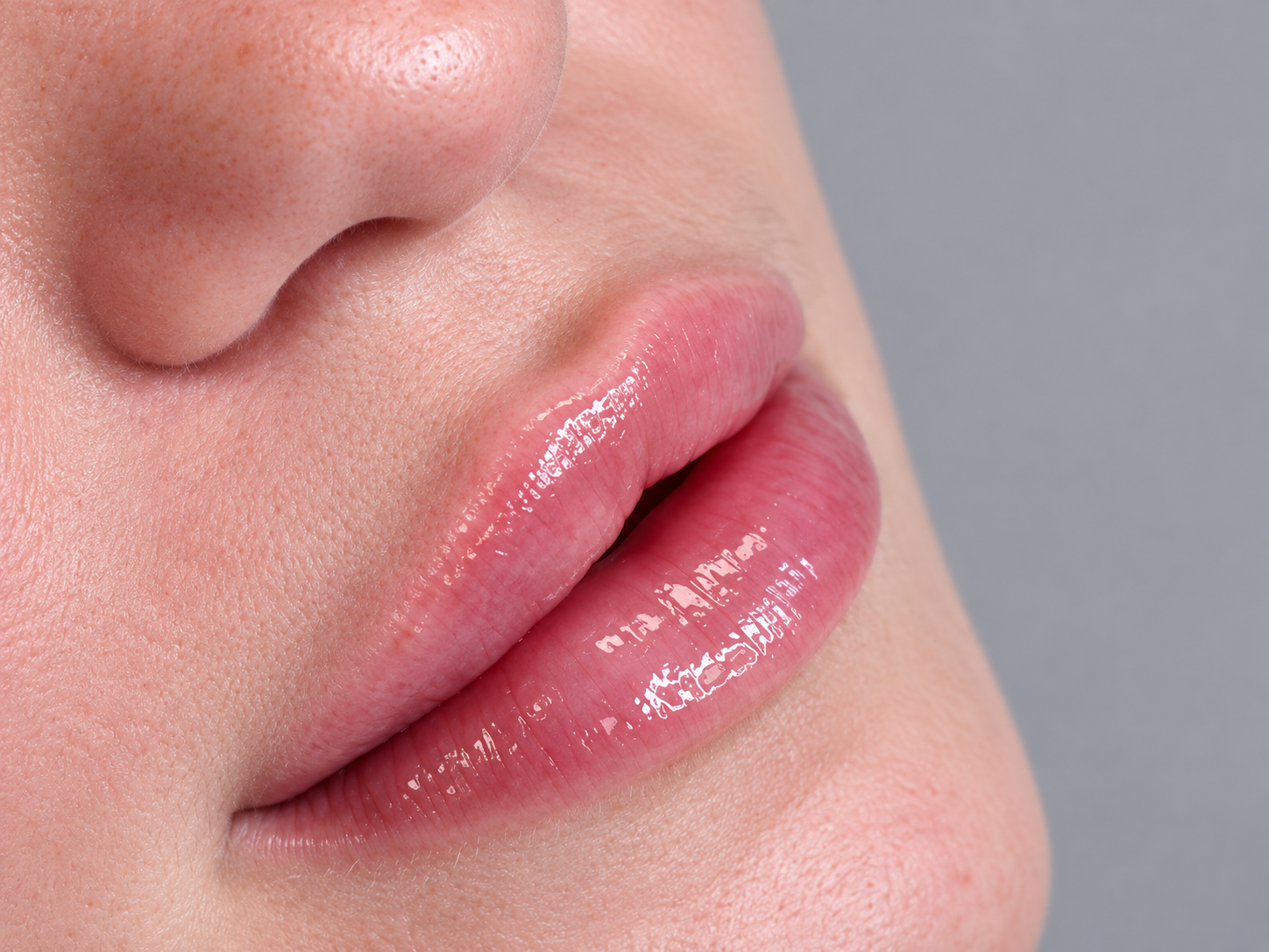 vasilica-manchester-aesthetic-lips-filler-volumen-vasilica